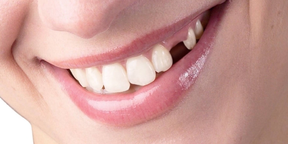 Diş Hekimleri Nasıl Bir Eğitim Alıyor ?