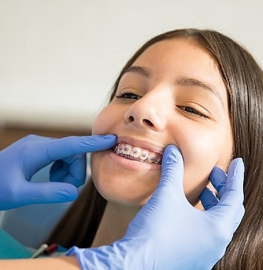 ortodontik-tedaviler-icin-ergenlik-en-ideal-donem