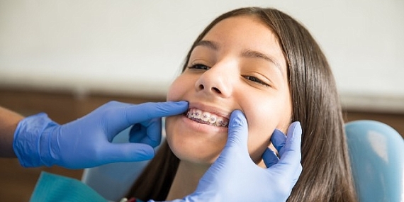 Ortodontik Tedaviler İçin ‘Ergenlik’ En İdeal Dönem