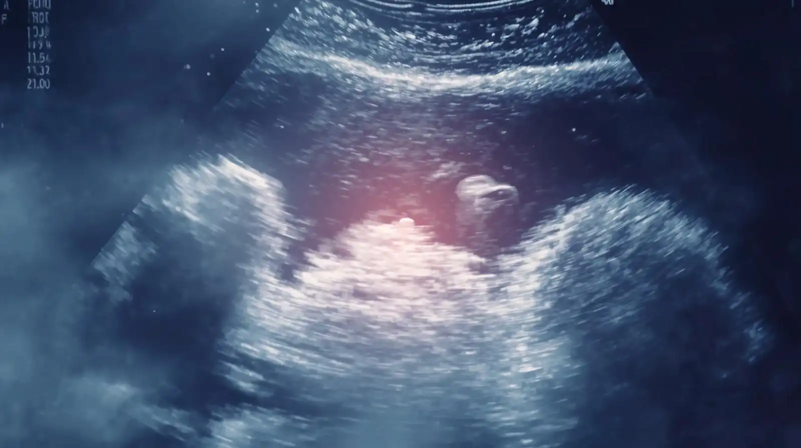 Rüyada Ultrasonda Bebek Görmek Ne Anlama Gelir?