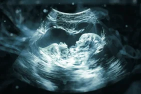 ultrasonda-bebek (4)