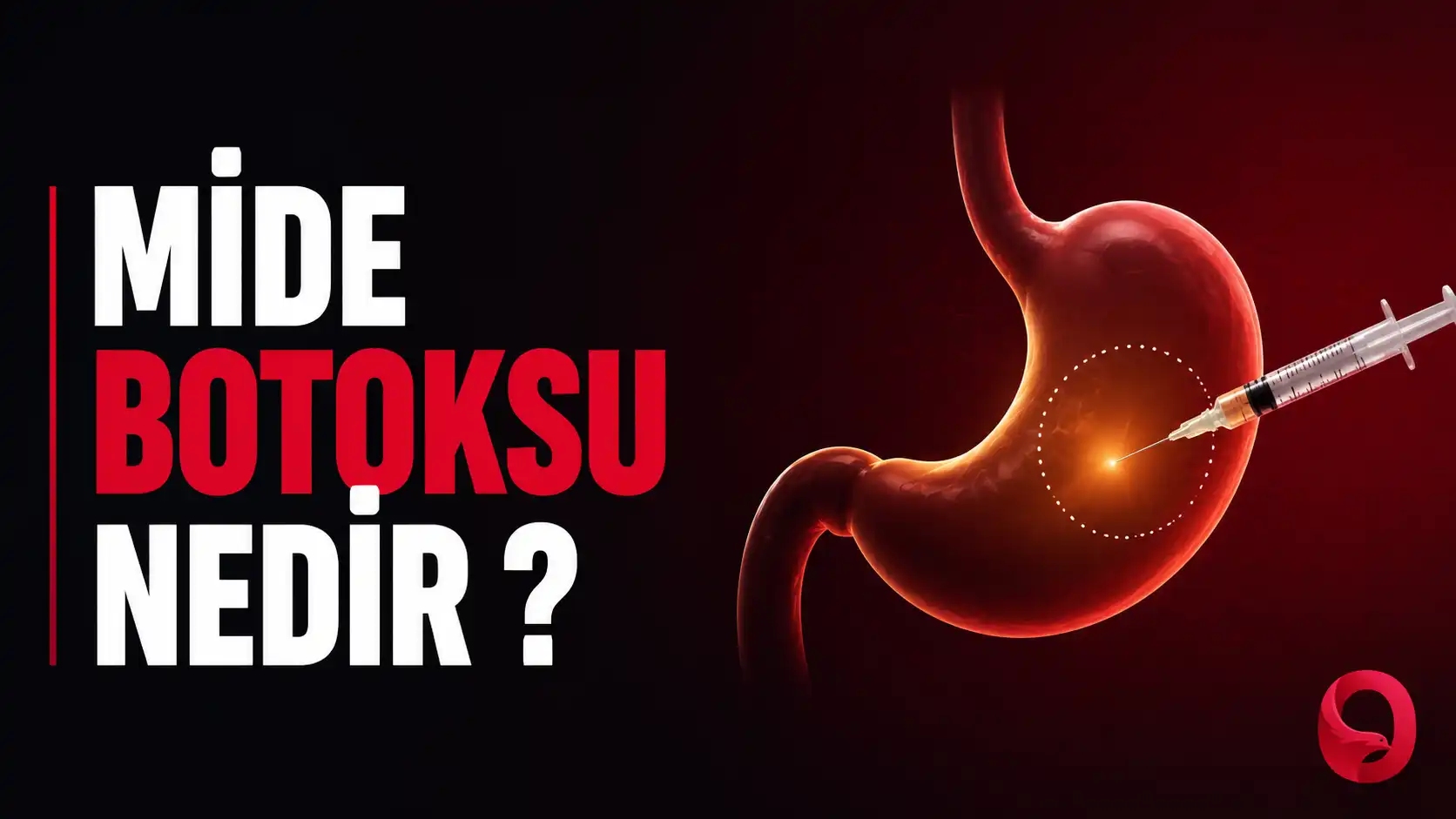 Mide Botoksu Gerçekten İşe Yarıyor mu? (Zayıflamak İsterken Sağlığınızdan Olmayın!)
