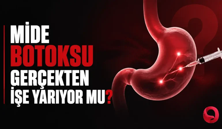 mide-botoksu (2)